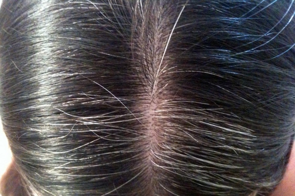 Πώς θα καλύψετε τις άσπρες τρίχες στα μαλλιά σας χωρίς να τα βάψετε;